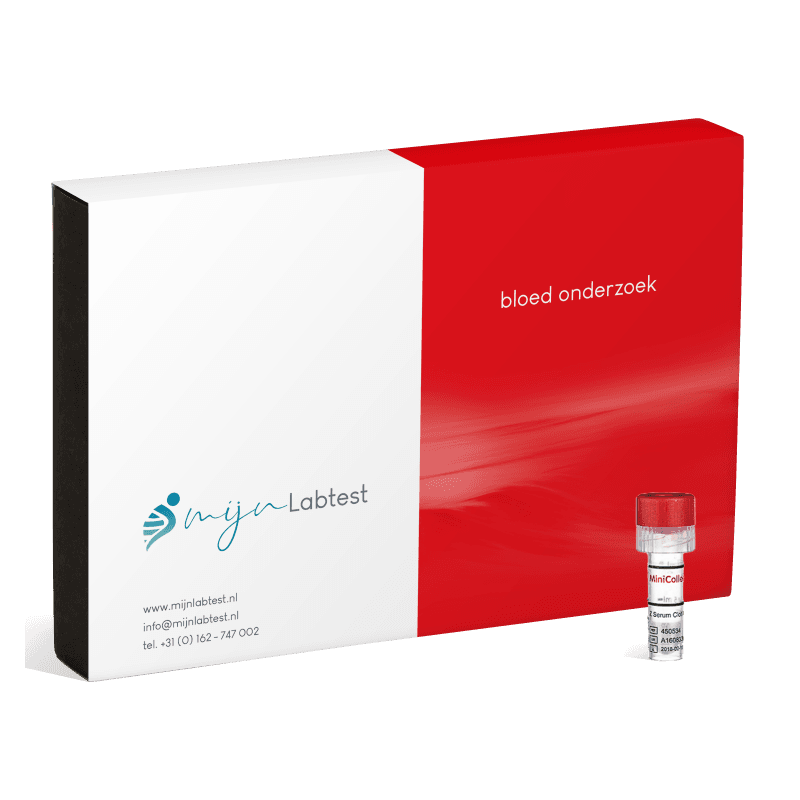 Mijnlabtest Testosteron test